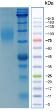 CLL1-HIS.jpg