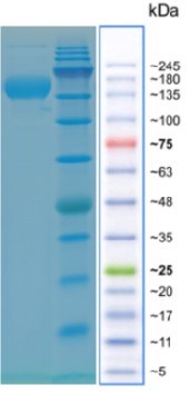 CLL1-FC.jpg