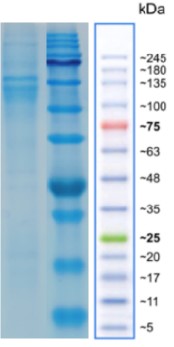 DLL3-CYNO-HIS.jpg