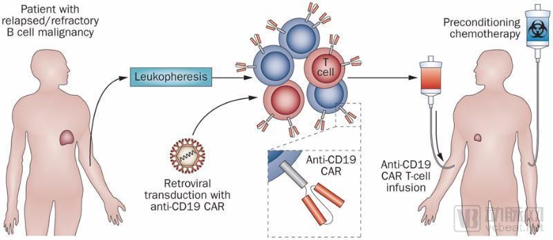 CAR-T.jpg
